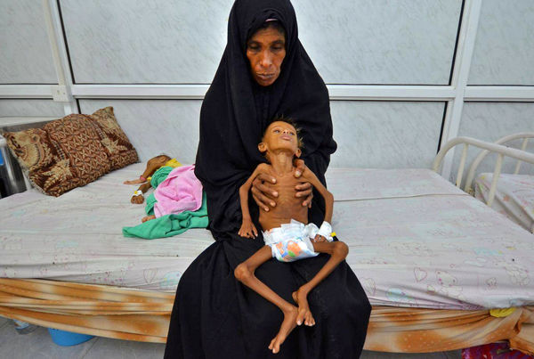 یمن در میانه فاجعه انسانی 