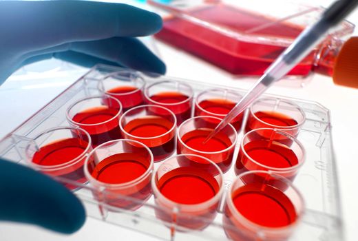 ۴۰ درصد سرطان‌ها قابل پیشگیری است