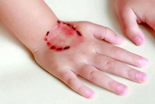 راه‌اندازی سامانه یکپارچه ثبت گزش /هزینه سالانه واکسیناسیون هاری به ۱.۵ همت رسید